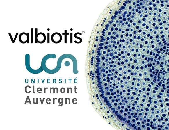 Microbiote intestinal : Valbiotis signe un partenariat de recherche avec l’Unité MEDIS de l'Université Clermont Auvergne.